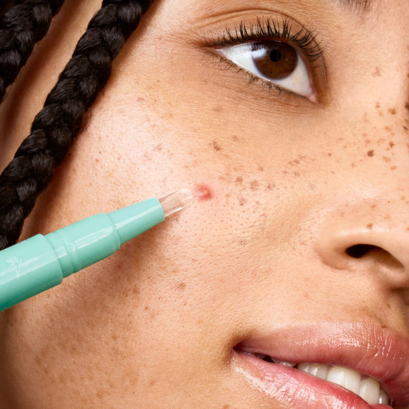 Astra Skin Anti Blemish Treatment, gerichte spot treatment tegen onzuiverheden met penapplicator