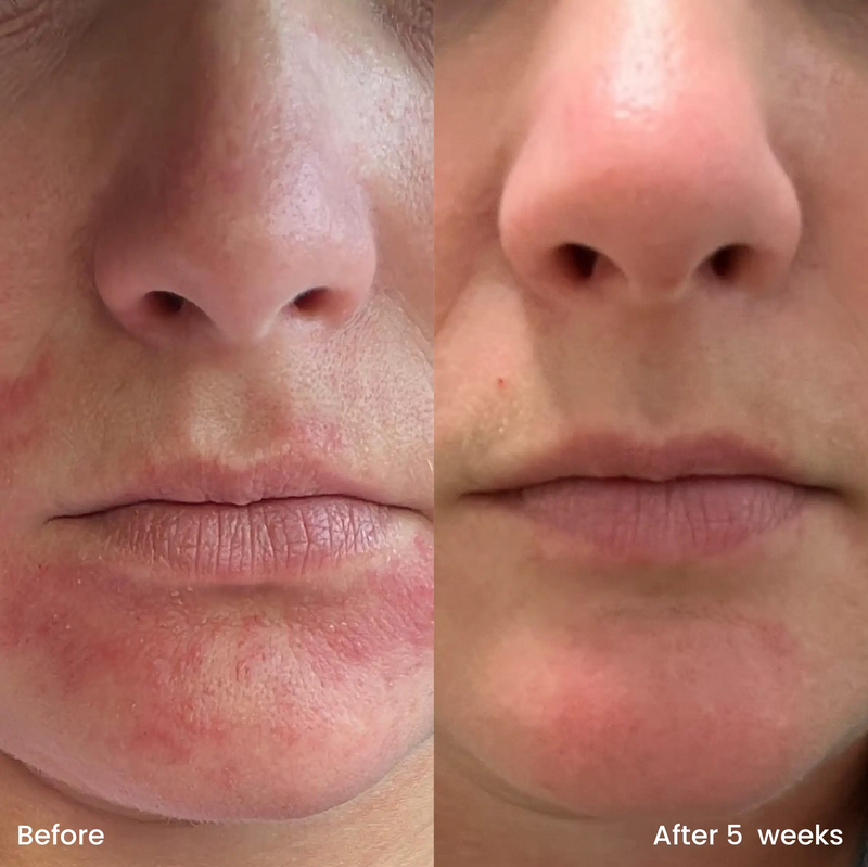 Clay And Glow Hydrating Moisturizer