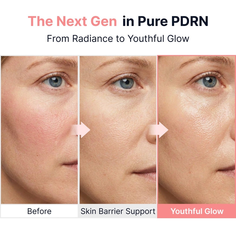 Sungboon Editor X Toy Story Pink Pdrn Glow Boosting Ampoule 3