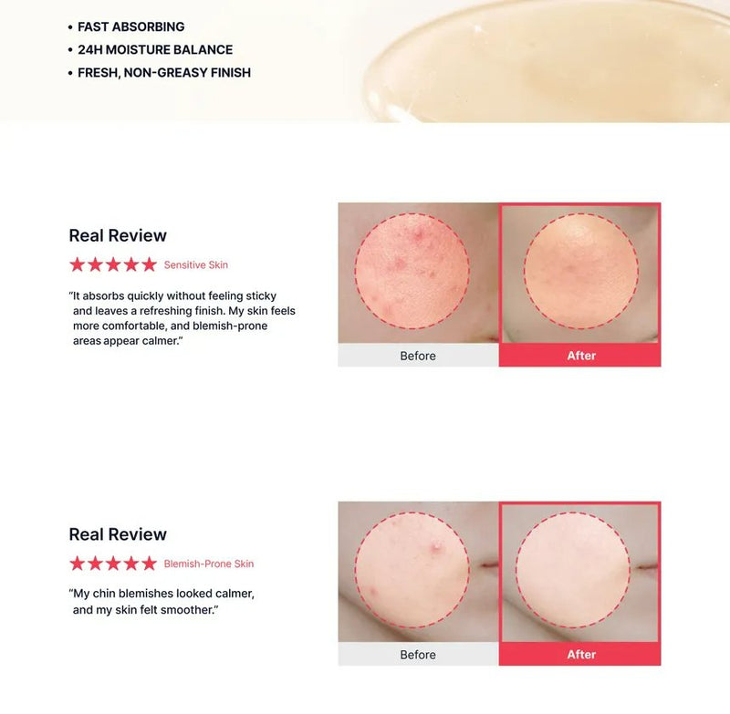 Sungboon Editor X Toy Story Red Heartleaf Bha Lino Relief Ampoule 2