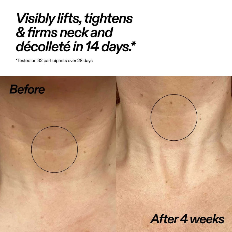 The Inkey List Bio-active Ceramide Neck Stick, nekbehandeling in stickvorm