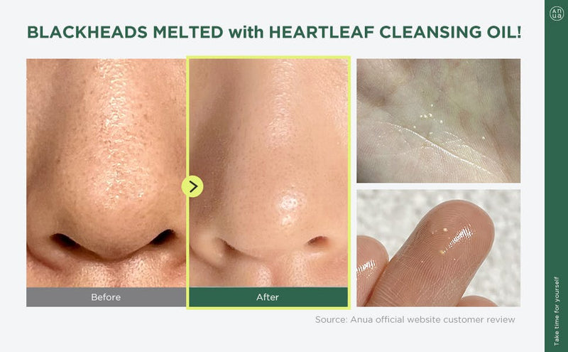 Anua Heartleaf Pore Control Cleansing Oil 20 ml.
