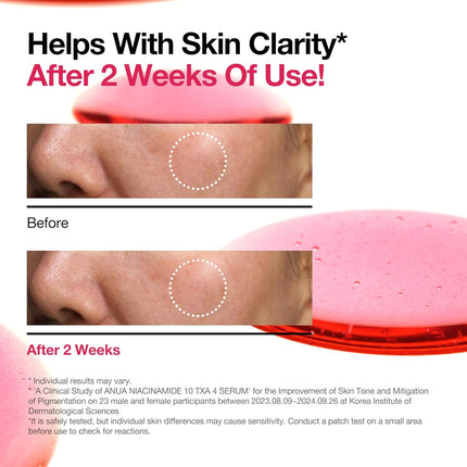 Anua Niacinamide 10% + TXA 4%  Dark Spot Correcting Serum