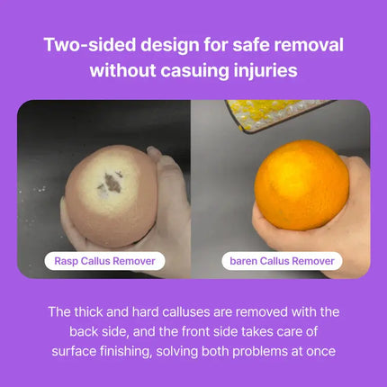 Baren Remover Magic Stainless Pro Dobule Sided Foot File