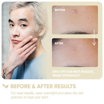 BreakoutAid Emergency Dots For Spots Niacinamide and Zinc