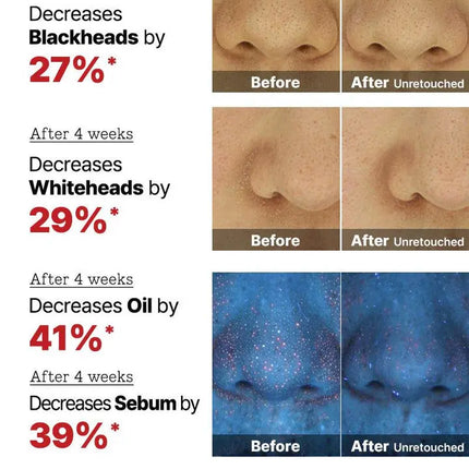 COSRX The AHA 2 BHA 2 Blemish Treatment Serum