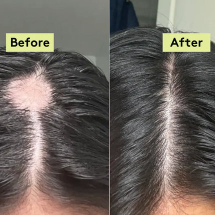 Delhicious Rich Roots Hair & Scalp Oil Amla & Rosemary