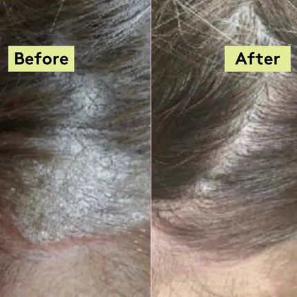 Delhicious Scalp-Eaze Scalp Balm Amla Berry & Mango Butter