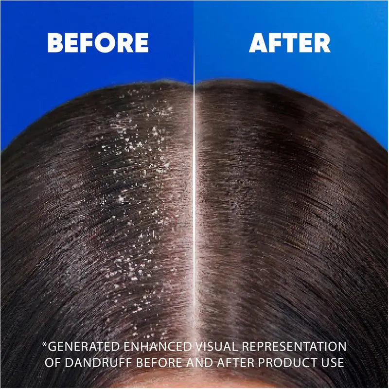 Head & Shoulders Citrus Shampoo