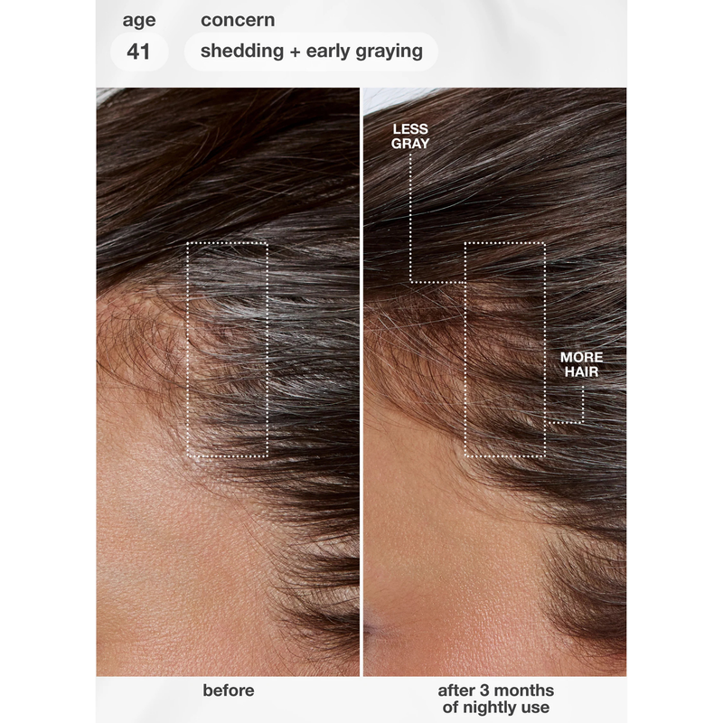 K18 Hair FutureIQ Biomimetic Hair Longevity Serum, haarserum tegen veroudering