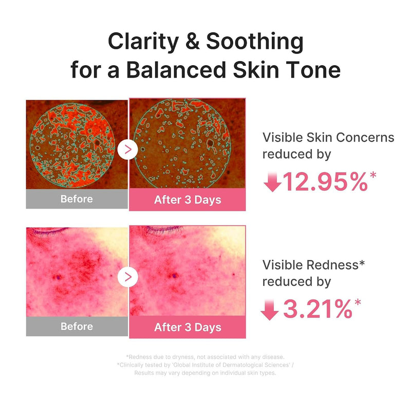 Medicube PDRN PINK Peptie Serum Ultra Light, een hydraterend gezichtsserum voor de vette en gecombineerde huid