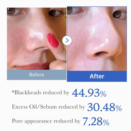 Medicube Zero Pore Pad 2.0