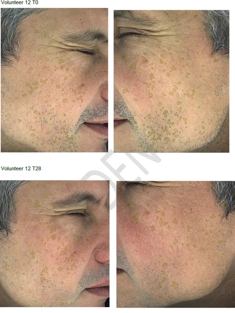 NERDS Hyperpigmentation Serum - 2% Alpha Arbutin + 1% Kojic Acid