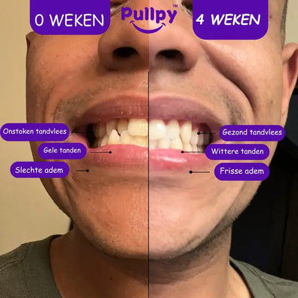 Pullpy Coco Munt Oil Pulling Mondspoeling