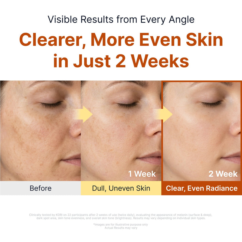Sungboon Editor X Toy Story Kojic Acid Niacinamide Brightening Ampoule 3
