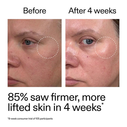The Inkey List Advanced Retinoid Serum