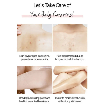 TIA’M Anti-blemish Body Lotion