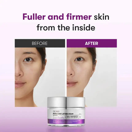 VT Cosmetics Reedle Shot Lifting Cream